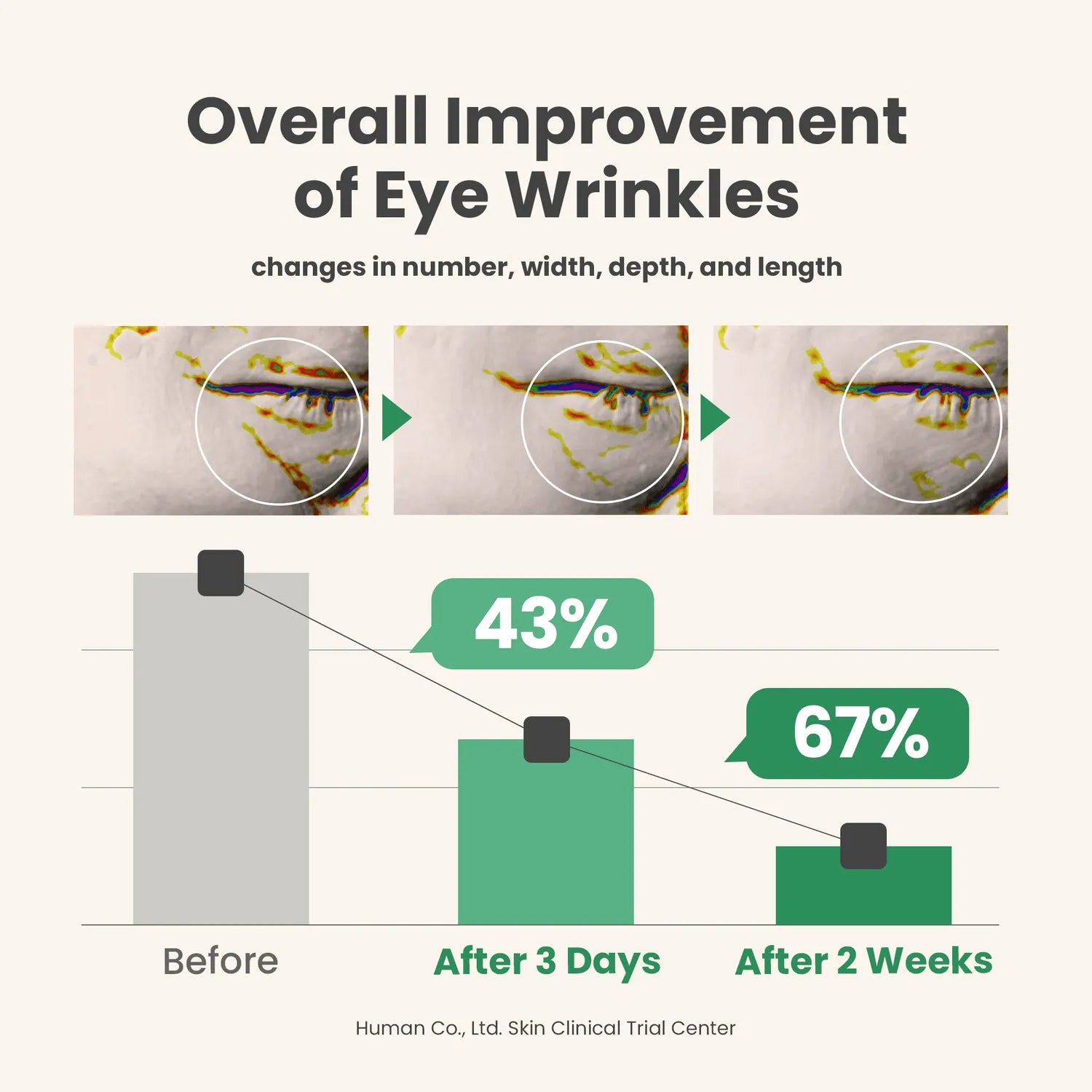 Vegan Collagen Eye Serum – Target Wrinkles, Puffiness &amp; Dark Circles