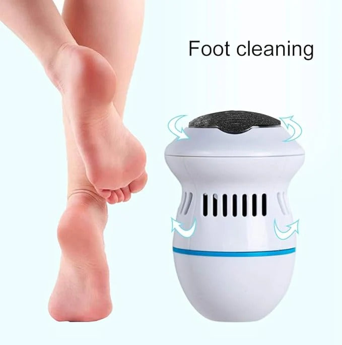 Miraj Mart™ Electric Callus Remover – Salon-Quality Smooth Feet at Home
