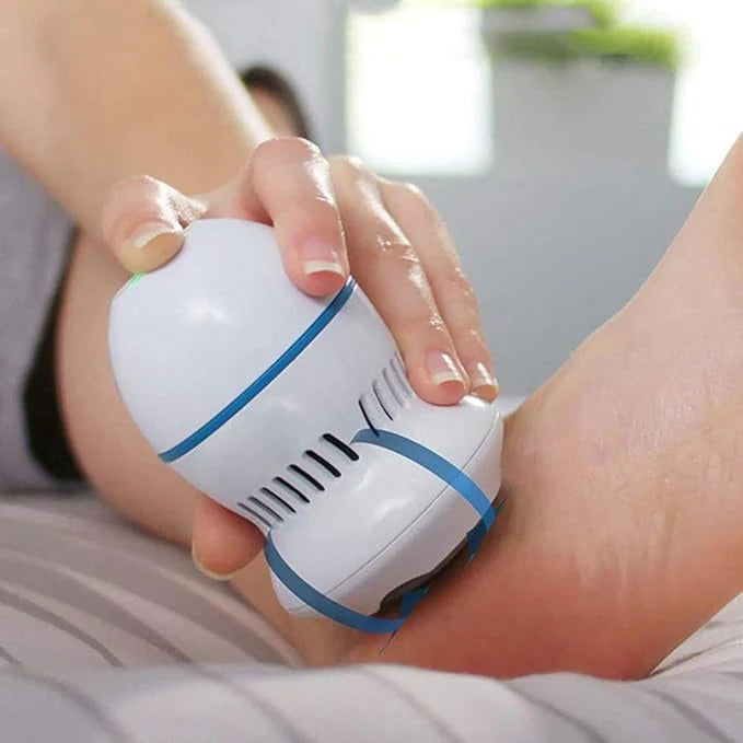 Miraj Mart™ Electric Callus Remover – Salon-Quality Smooth Feet at Home