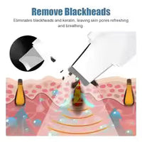 Deep Vibrate Skin Scrubber & Facial Peeling Cleaner